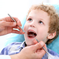 Carie_petite_enfance_Dentiste_pediatrique_Laval